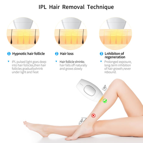 IPL Laser Hair Removal - skinnion